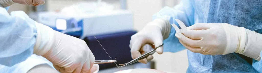 Пластична хірургія